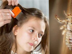 con chấy số mấy