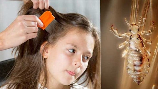 con chấy số mấy